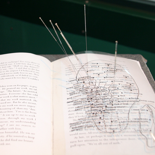 Manuscript accupuntured.